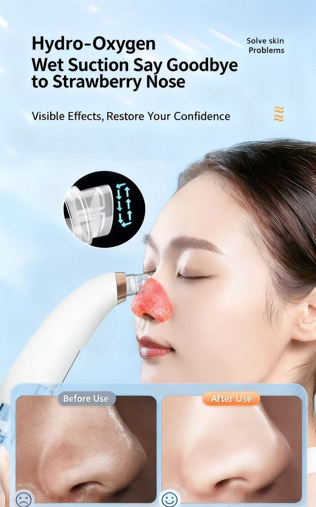 黑头清洁仪